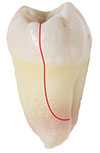 Stratham Split Tooth